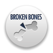 Los Angeles broken bone injury lawyers