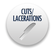 California Lawyers for Cuts and Lacerations Injuries